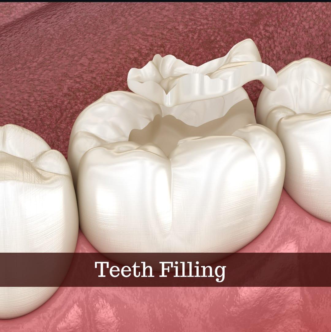Teeth Filling